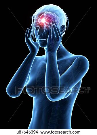 Stock Illustration - Human headache, illustration. Fotosearch
