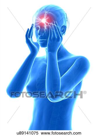Stock Illustration - Human headache, illustration. Fotosearch