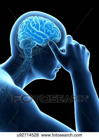 Stock Illustration - Human headache, illustration. Fotosearch
