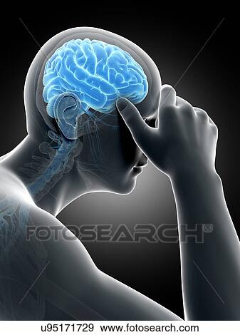 Stock Illustration - Human headache, illustration. Fotosearch