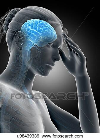 Human headache, illustration View Large Illustration Stock Illustration - Human headache, illustration. Fotosearch