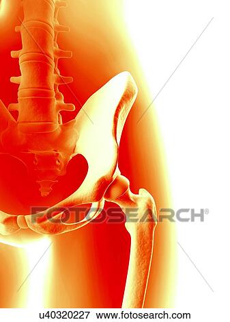 Stock Illustration - Human hip joint, illustration. Fotosearch