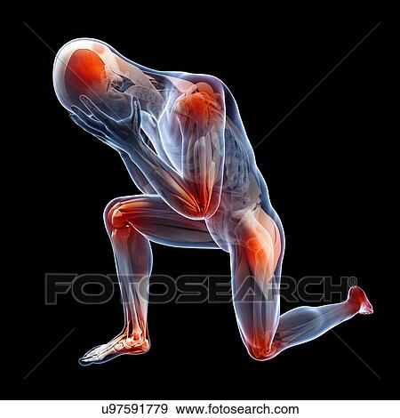 Human joint pain, illustration View Large Illustration Stock Illustration - Human joint pain, illustration. Fotosearch