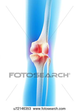 Human knee joint, illustration View Large Illustration Drawing - Human knee joint, illustration. Fotosearch