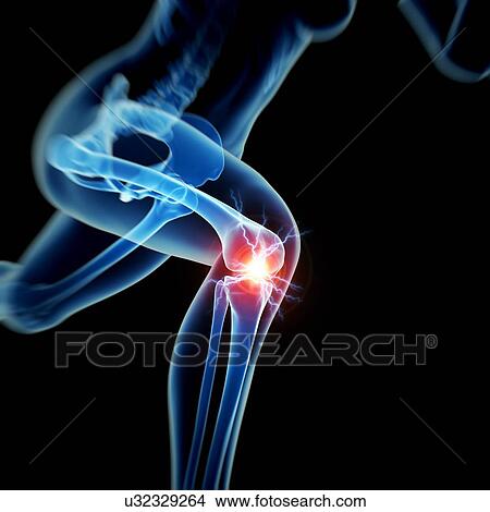 Human knee pain, illustration View Large Illustration Stock Illustration - Human knee pain, illustration. Fotosearch