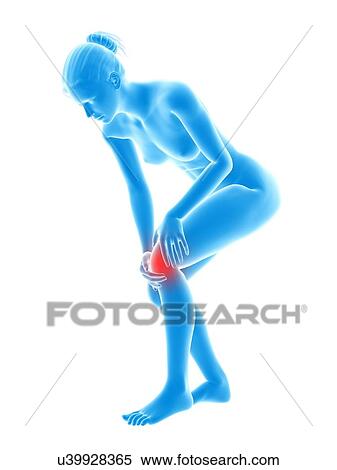 Human knee pain, illustration View Large Illustration Stock Illustration - Human knee pain, illustration. Fotosearch