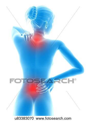 Human neck and back pain, illustration View Large Illustration Clipart - Human neck and back pain, illustration. Fotosearch