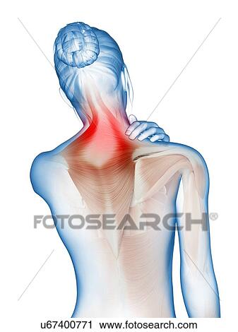 Clip Art - Human neck muscles, illustration. Fotosearch