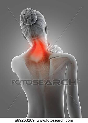 Stock Illustration - Human neck muscles, illustration. Fotosearch
