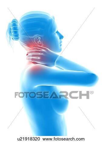Human neck pain, illustration View Large Illustration Clipart - Human neck pain, illustration. Fotosearch