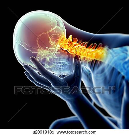 Human neck pain, illustration View Large Illustration Stock Illustration - Human neck pain, illustration. Fotosearch
