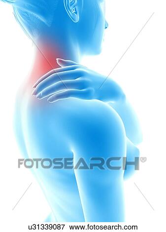 Stock Illustration - Human neck pain, illustration. Fotosearch