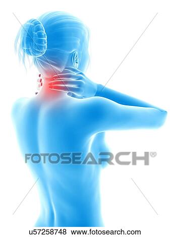 Stock Illustration - Human neck pain, illustration. Fotosearch