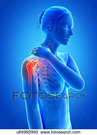 Human shoulder pain, illustration View Large Illustration Clipart - Human shoulder pain, illustration. Fotosearch