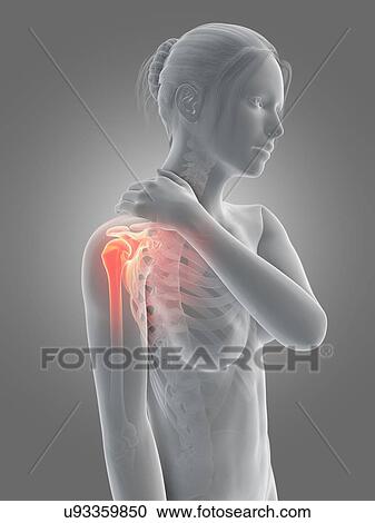 Human shoulder pain, illustration View Large Illustration Clipart - Human shoulder pain, illustration. Fotosearch