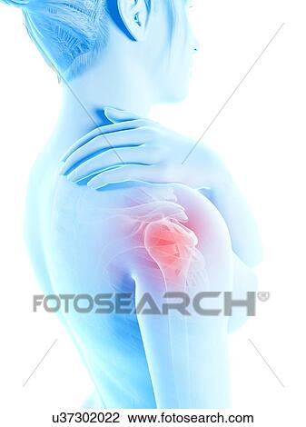 Human shoulder pain, illustration View Large Illustration Drawing - Human shoulder pain, illustration. Fotosearch