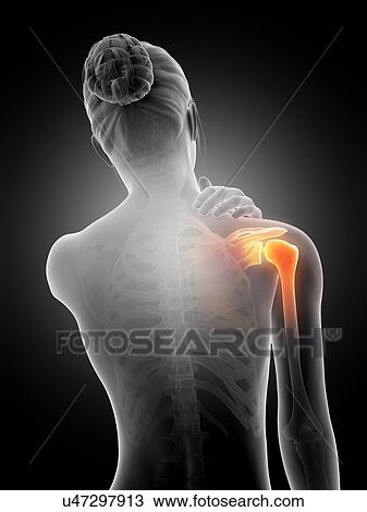 Human shoulder pain, illustration View Large Illustration Drawing - Human shoulder pain, illustration. Fotosearch