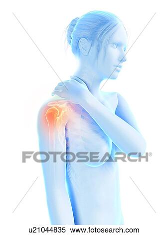 Stock Illustration - Human shoulder pain, illustration. Fotosearch