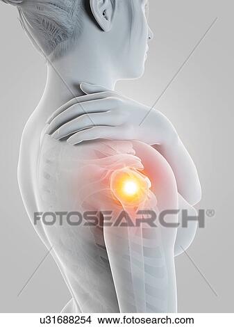 Human shoulder pain, illustration View Large Illustration Stock Illustration - Human shoulder pain, illustration. Fotosearch