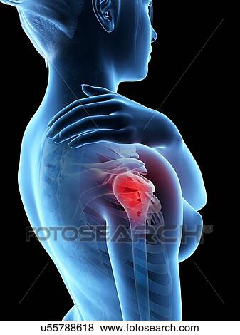 Human shoulder pain, illustration View Large Illustration Stock Illustration - Human shoulder pain, illustration. Fotosearch