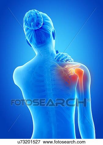 Human shoulder pain, illustration View Large Illustration Stock Illustration - Human shoulder pain, illustration. Fotosearch