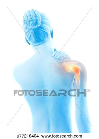 Stock Illustration - Human shoulder pain, illustration. Fotosearch