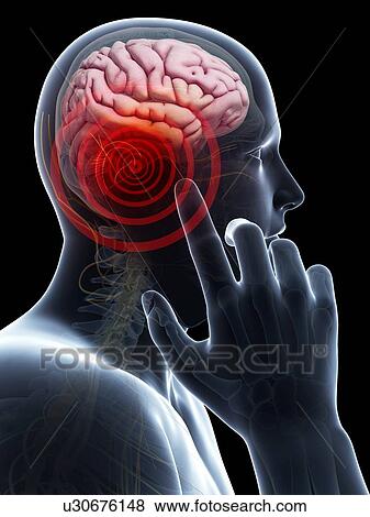 Stock Illustration - Mobile phone usage risk, illustration. Fotosearch