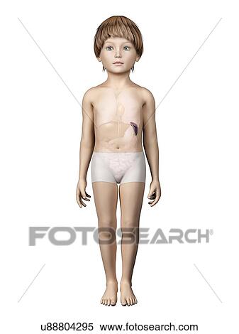 Stock Illustration - Spleen of boy, illustration. Fotosearch