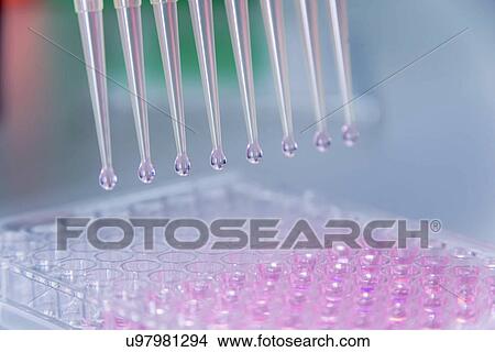 "Cancer research laboratory, cells being dispensed using electronic pipette" View Large Photo Image Picture - "Cancer research laboratory, cells being dispensed using electronic pipette". Fotosearch