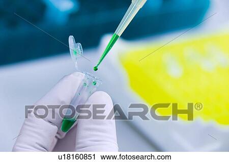 Stock Image - "Cancer research laboratory, fingers of scientist working with cells kept in ice after storage in sub zero temperatures in a liquid nitrogen cryopreservation chamber". Fotosearch