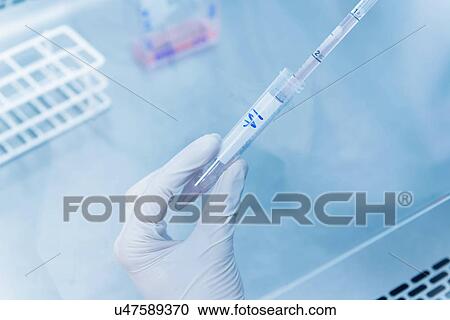 Stock Image - "Cancer research laboratory, hands of male scientist dispensing cells with an electronic pipette". Fotosearch