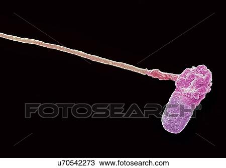 "Abnormal human sperm cell, SEM" View Large Illustration Drawing - "Abnormal human sperm cell, SEM". Fotosearch