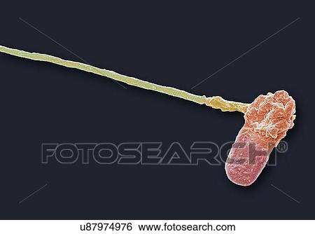 Stock Illustration - "Abnormal human sperm cell, SEM". Fotosearch