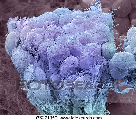 "Fat tissue, SEM" View Large Illustration Clipart - "Fat tissue, SEM". Fotosearch