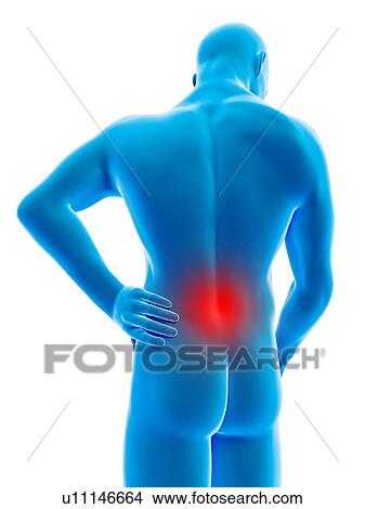 Stock Illustration - "Human back ache, illustration". Fotosearch