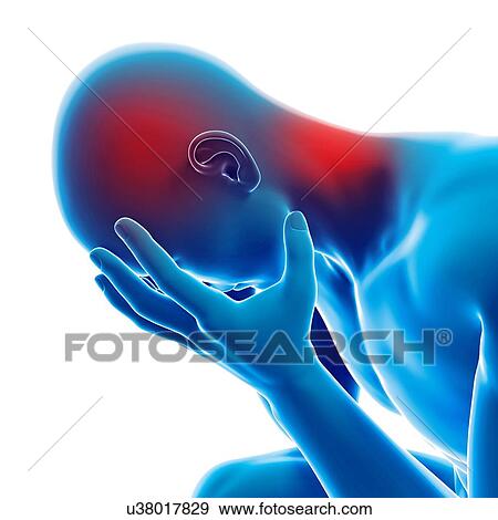"Human headache, illustration" View Large Illustration Stock Illustration - "Human headache, illustration". Fotosearch