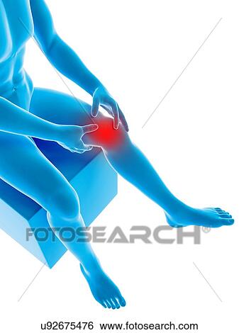 Stock Illustration - "Human knee pain, illustration". Fotosearch