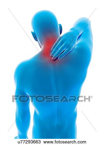 "Human neck ache, illustration" View Large Illustration Drawing - "Human neck ache, illustration". Fotosearch