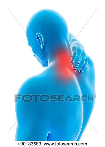 "Human neck ache, illustration" View Large Illustration Drawing - "Human neck ache, illustration". Fotosearch