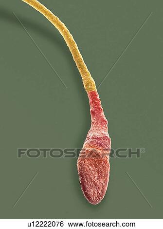 Stock Illustration - "Human sperm cell, SEM". Fotosearch