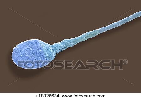 "Human sperm cell, SEM" View Large Illustration Stock Illustration - "Human sperm cell, SEM". Fotosearch