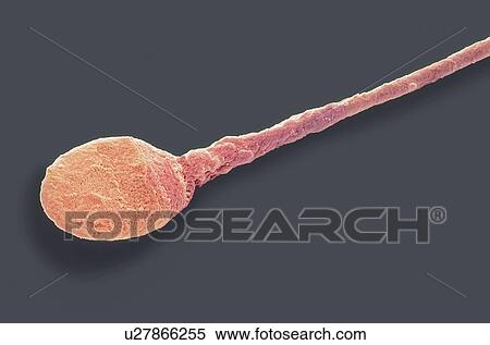 "Human sperm cell, SEM" View Large Illustration Stock Illustration - "Human sperm cell, SEM". Fotosearch