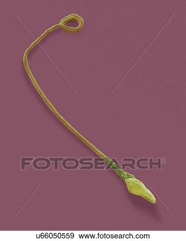 Stock Illustration - "Human sperm cell, SEM". Fotosearch