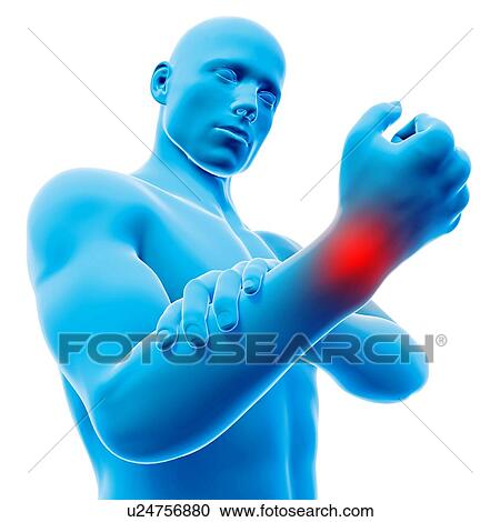 "Human wrist pain, illustration" View Large Illustration Clipart - "Human wrist pain, illustration". Fotosearch