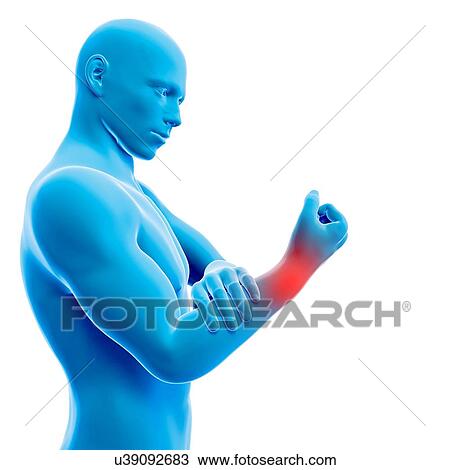 Drawing - "Human wrist pain, illustration". Fotosearch