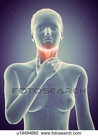 Drawing - "Inflammation of the larynx, illustration". Fotosearch