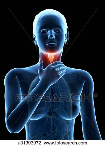 Drawing - "Inflammation of the larynx, illustration". Fotosearch