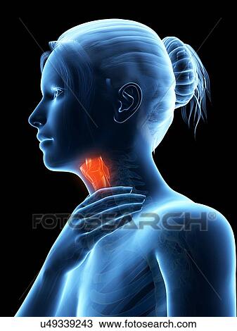 Drawing - "Inflammation of the larynx, illustration". Fotosearch