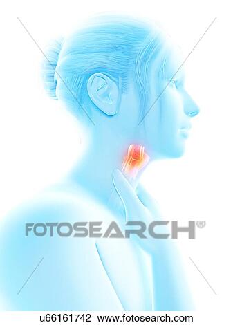 Drawing - "Inflammation of the larynx, illustration". Fotosearch