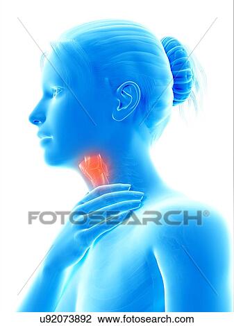 "Inflammation of the larynx, illustration" View Large Illustration Drawing - "Inflammation of the larynx, illustration". Fotosearch